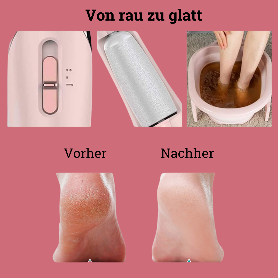 PedicurePro Elektrischer Hornhautentferner