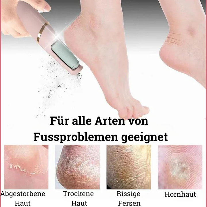 PedicurePro Elektrischer Hornhautentferner